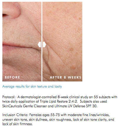 Triple Lipid Restore Before & After