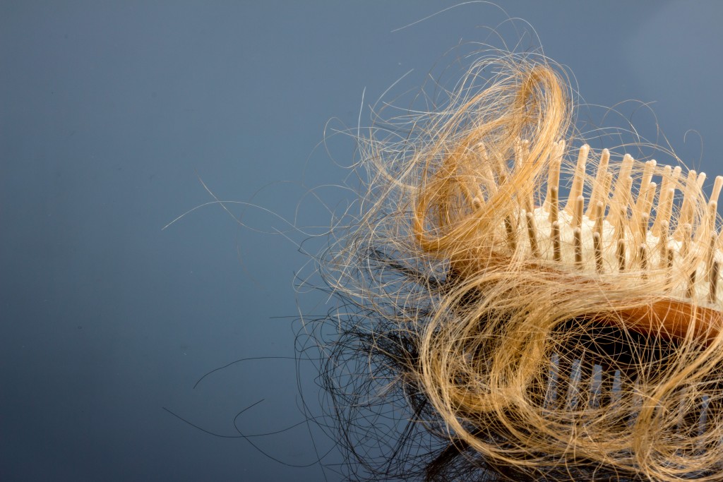 Eine Haarbürste mit Haeren. Beginn von Haarausfall und Alopezie